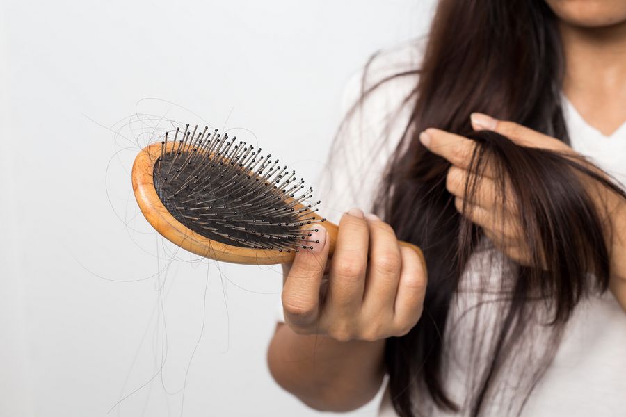 female hair loss products