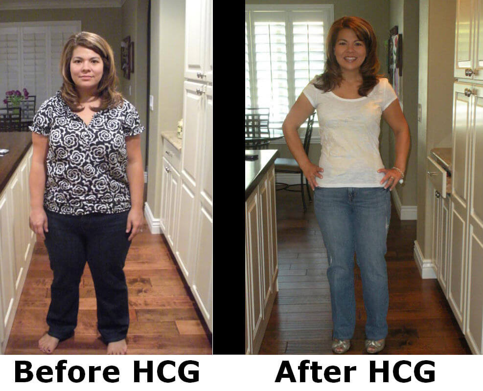 hcg diet plan before after